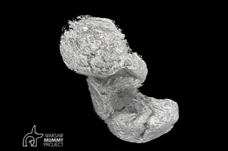 Płód mumii zachował się dzięki nietypowemu procesowi rozkładu (fot. Warsaw Mummy Project)